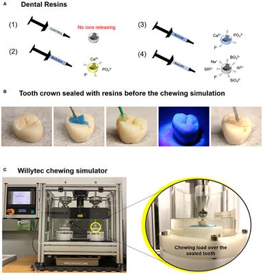 Wear Behavior and Surface Quality of Dental Bioactive Ions-Releasing Resins Under Simulated Chewing Conditions